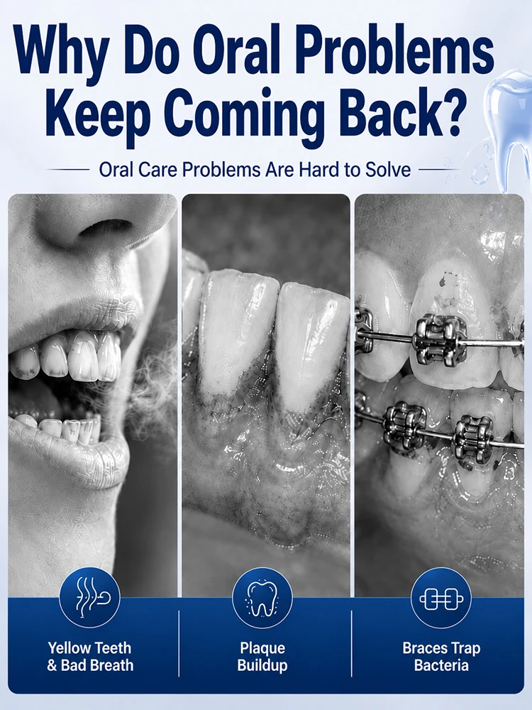 Thumbnail 2 - #3 Compare Dental Water Jets Before You Buy