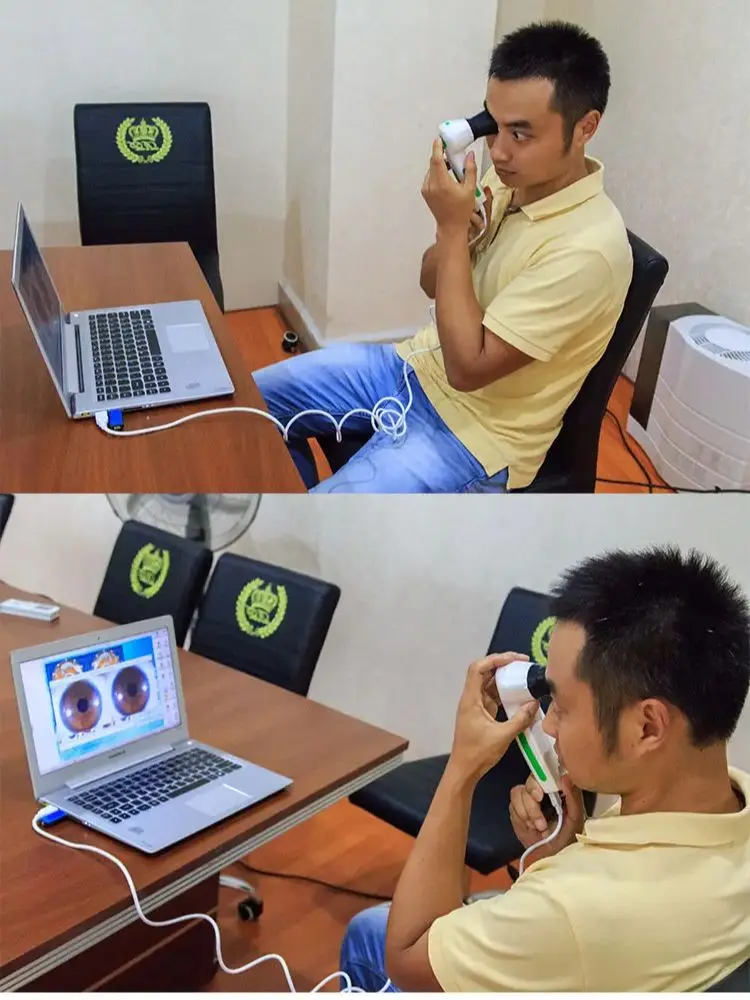 

Eye iris enlargement 12MP pixels usb iriscope iris analyzer iridology camera customize design prototype with Spanish software