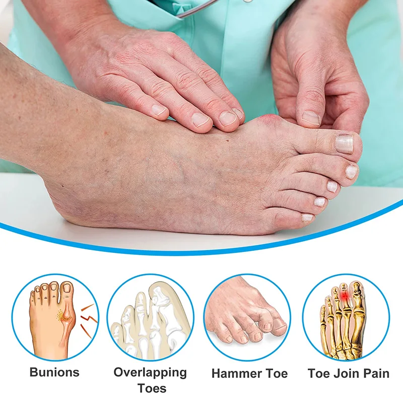 Pexmen z miękkim żelem Toe Spacer separatory korektor Bunion na nakładające się palce palucha Bunion ulga w bólu pielęgnacja stóp Protector