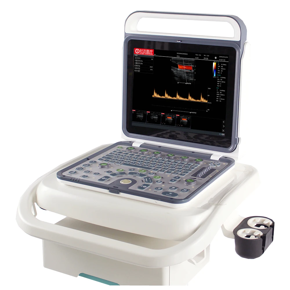 Новейшее ультразвуковое оборудование SMA M60 Ultra Sound, портативная ультразвуковая машина