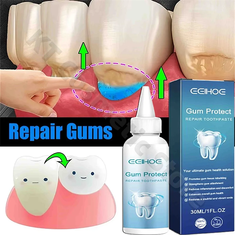 Rapid Repairing Gum Atrophy Toothpaste Effectively Relieve Dental Allergies Deep Cleaning Tooth Caries Damaged Teeth Care Serum