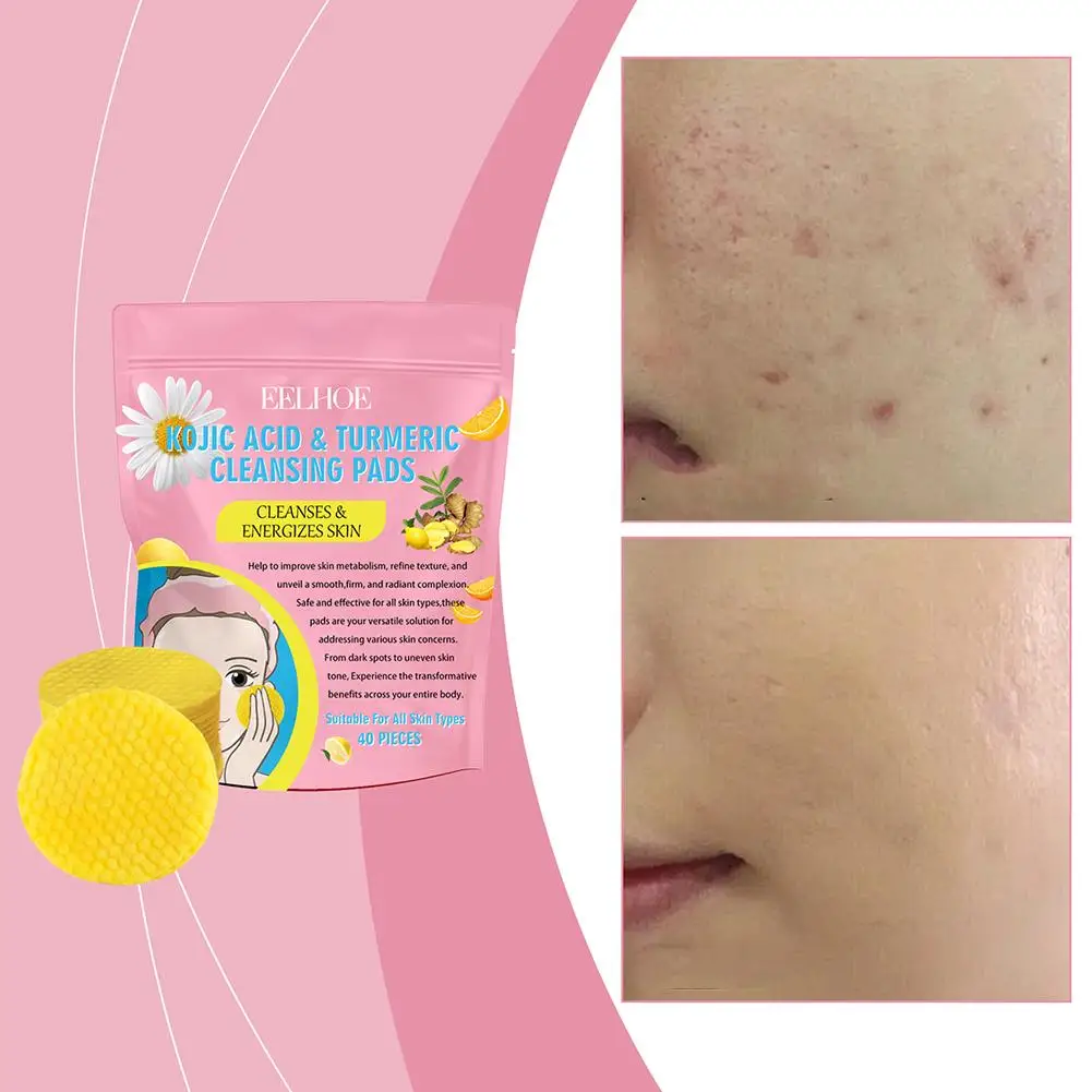 40 stücke Kurkuma Koji säure Reinigungs pads Peeling Pads Gesichts schwämme zur Reinigung und Peeling Entfernung abgestorbener Haut