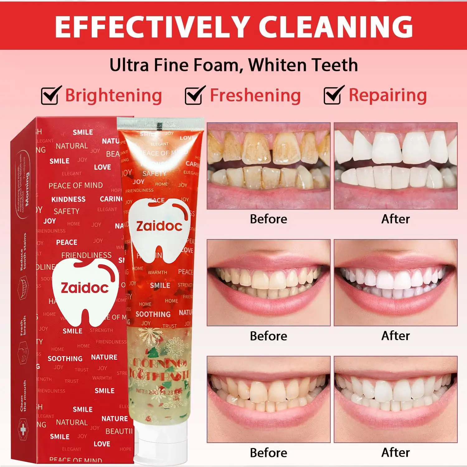 ZaiDoc 3Pcs Toothpaste Set : Probiotic + Coconut Whitening + Clear Gel with Christmas Hearts Nano Hydroxyapatite Natural Oral Care 120g Each