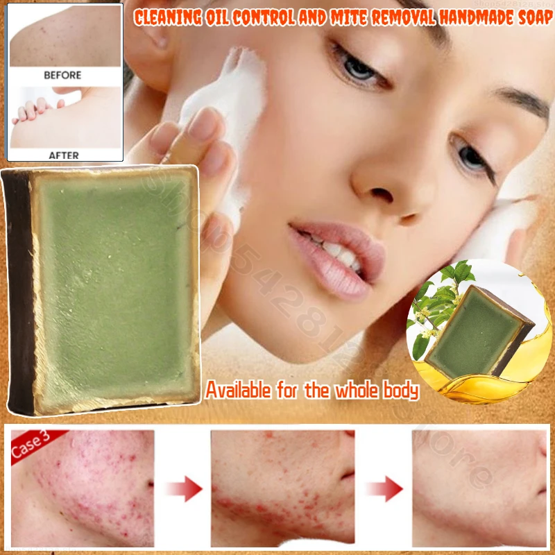 

Gentle Cleansing Scalp Cleaning Pure Handmade Soap Cleansing Skin Dirt Removal Mite Removal Oil Control Soap 100g