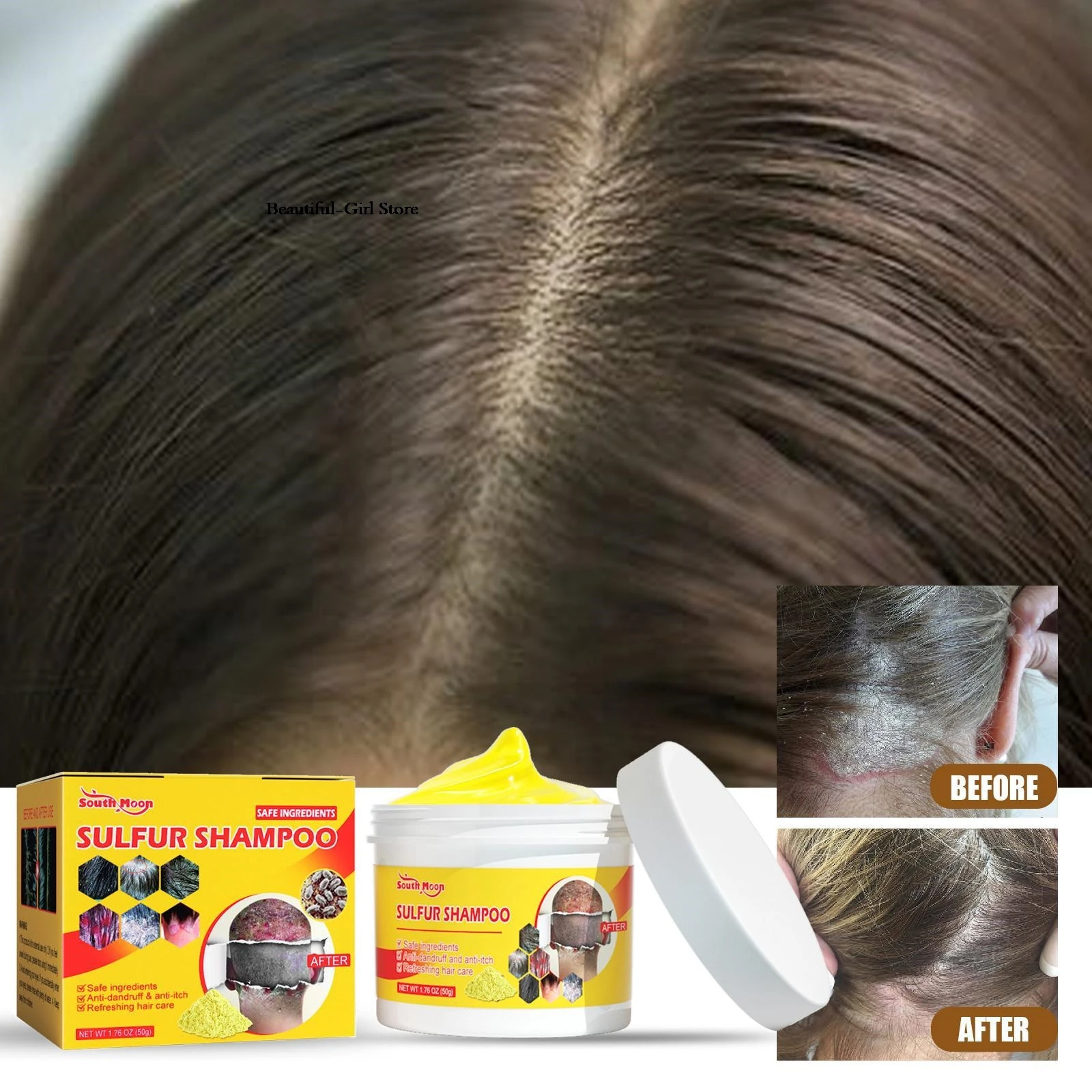 Champú de azufre (3 piezas) para eliminar piojos, ácaros, caspa, picazón y grasa, control profundo de los folículos, limpieza capilar, cuidado antipruriginoso y nutrición del cuero cabelludo