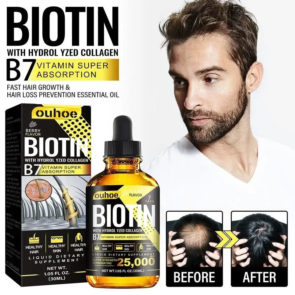 

30ml Nutrition Biotin Liquid Drops Essential Oil Collagen B7 Vitamin Oil Trengthen Hair Root Anti Hair Weak Treatment