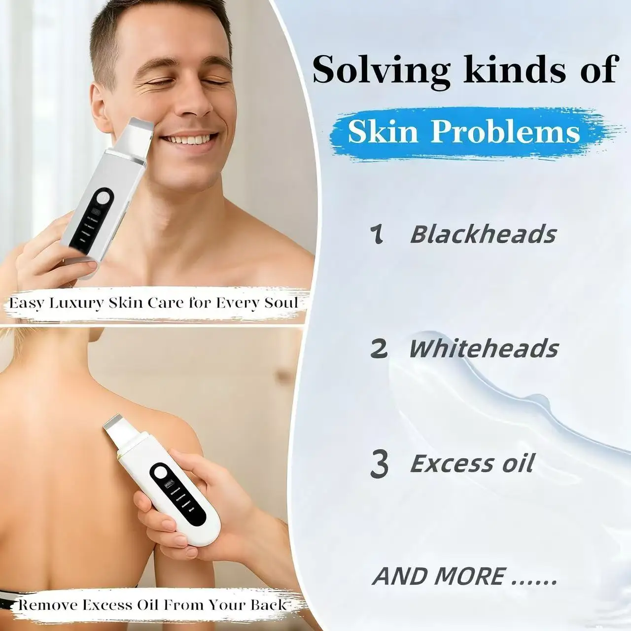 آلة تنظيف الوجه العميق بالموجات فوق الصوتية، منظف البشرة، إزالة الأوساخ، الرؤوس السوداء، تقليل البقع والتجاعيد، تبييض الوجه #3