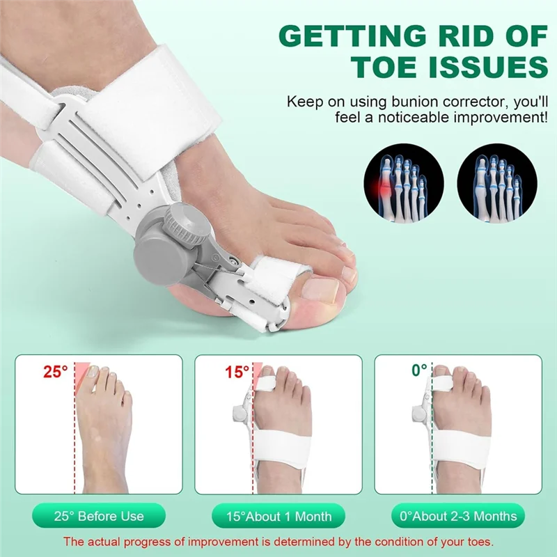 

A35R Bunion Corrector Bunion Corrector For Women Big Toe Adjustable Bunion Corrector Right Foot