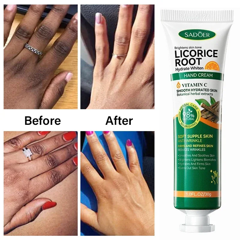 Dark Knuckles Brighten Hand Cream Wrinkle Removal Anti-Crack Fast Whitening Melanin Corrector Moisturizing Hand Care Lotion 30g