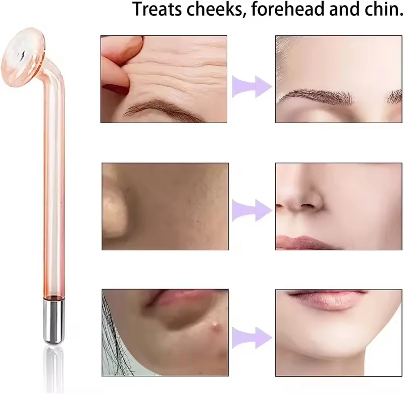 Varita de electrodo de alta frecuencia: tubo de vidrio de repuesto para máquinas faciales con punta de seta, accesorios de peine transparente, varita única