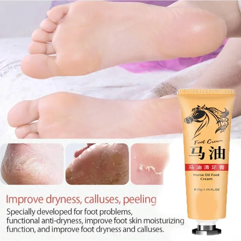 Horse Oil Skin Cream Anti-cracking Ointment Prevents Dry Skin Moisturizes Protects Fingers Feet and Skin Care Products