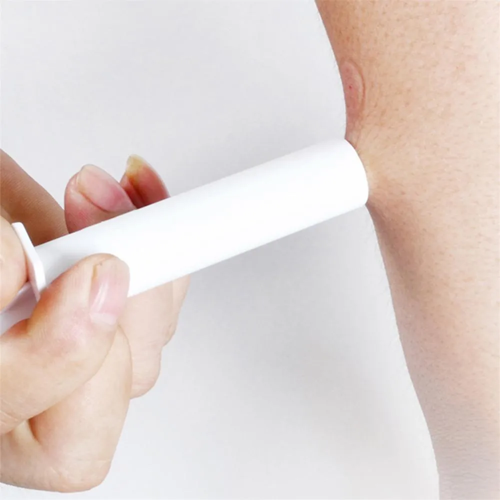 휴대용 독극물 추출기 진공 디펜서, 모기 물림, 야외 약물 추출기, 야외 캠핑 비상 도구, 1 ~ 10 개