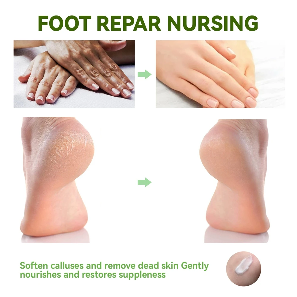 50g Urea 42% Foot Cream Hand Anti Cracking Moisturizing Calluses Dead Skin Repair Rehydration Soften Cuticle Smooth Restore