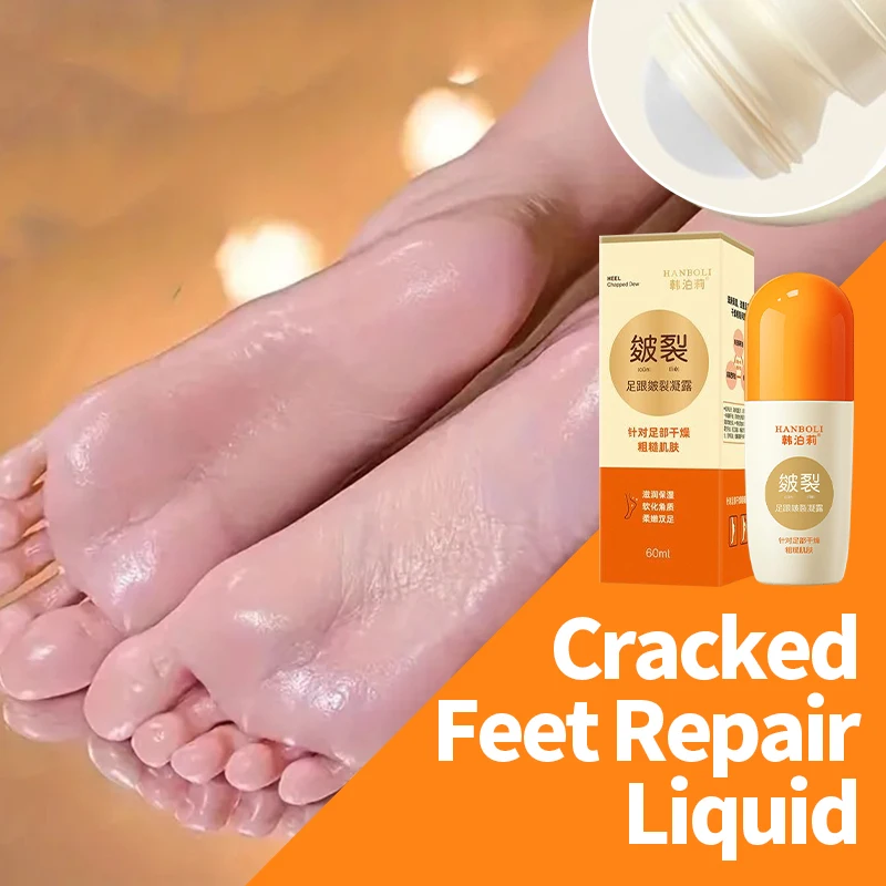 

Anti Crack Foot Cream Drying Cracked Feet Repair Hand Dead Skin Removal Peeling Heel Chapped Moisturizing Care Foot Mask Dew