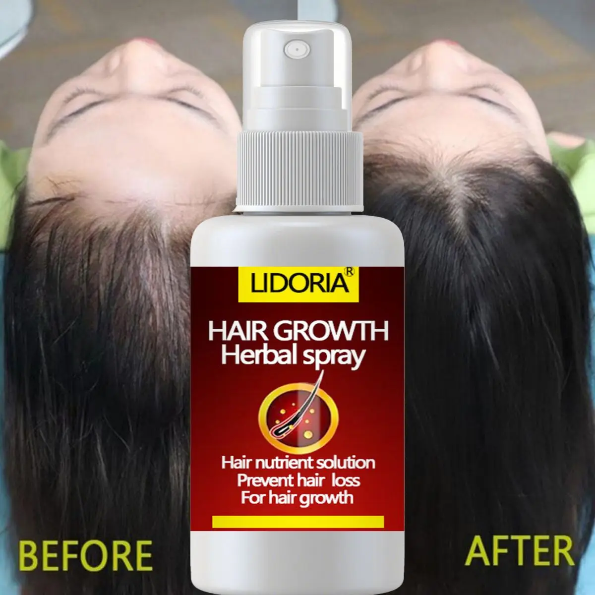 Hair Growth Serum Spray Fast Hair Growth Liquid Treatment Scalp Hair Follicle Anti Hair Loss Natural Beauty Health Hair Care