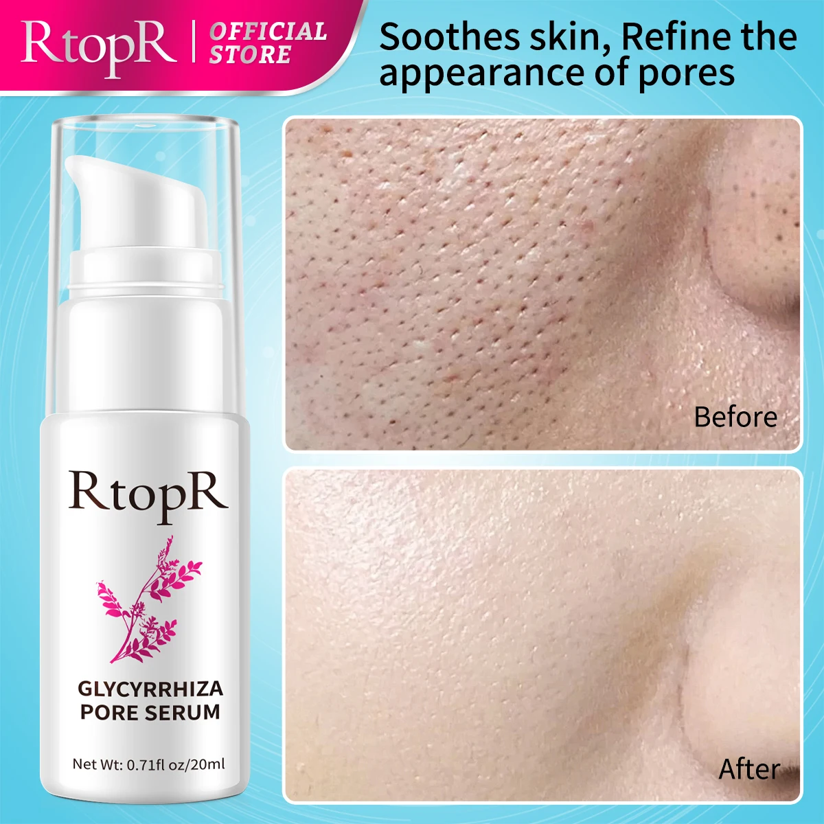 RtopR Pore Shrinking Facial Essence Moisturizing Moisturizing Essence Firming Brightening Beauty Korean Cosmetics Face Care