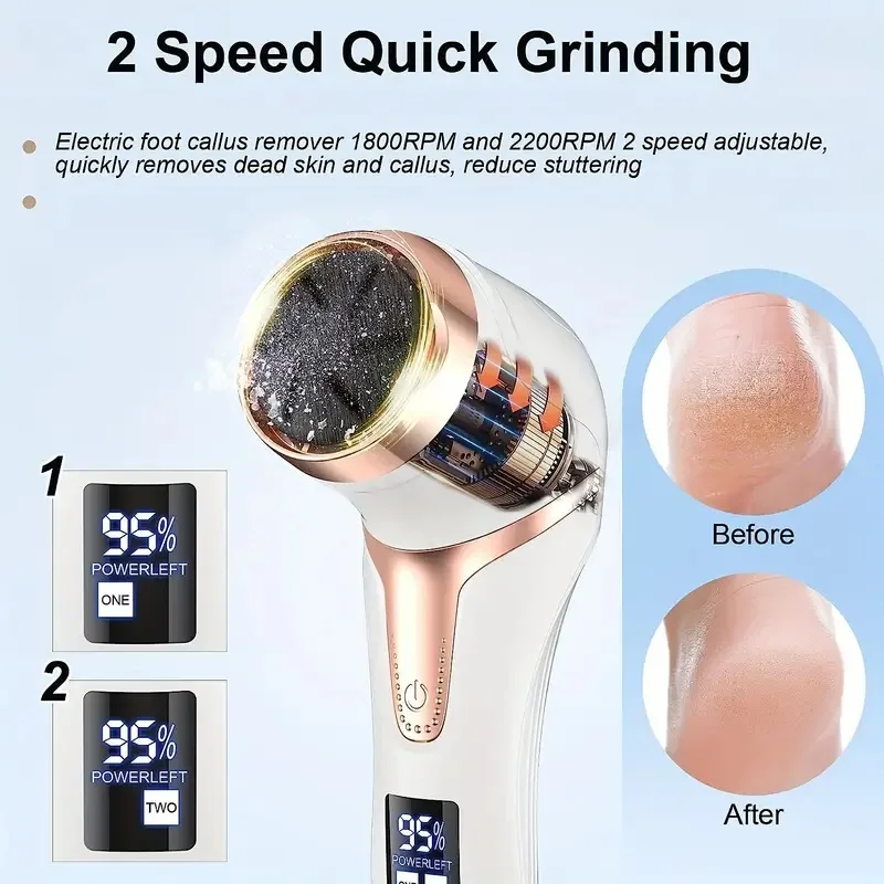 Professional Electric Callus Remover For Feet - Rechargeable Foot Care Kit With 3 Heads, Dander Vacuum Cleaner, LCD Display image 2