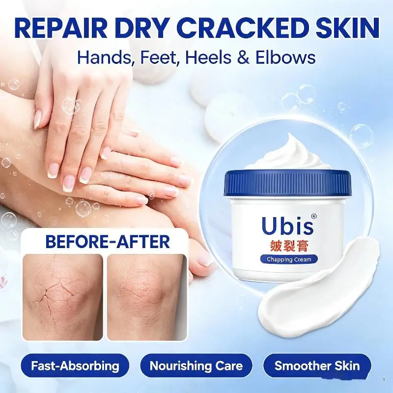 Ubis Anti Chapping Cream Long Lasting Moisturizing Effective Repair for Dry Cracked Heels Foot Care