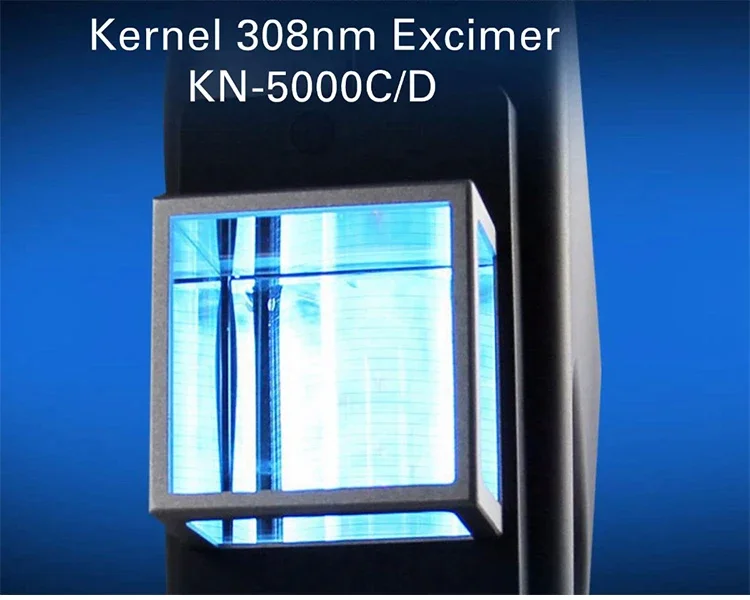 Lampade Uvb ultimo Kernel Kn-5000c Eximer Laser 308nm lampada vitiligine 308nm luce Uvb per psoriasi vitiligine Cure