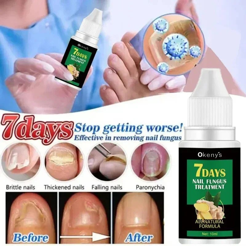 Extra Strong Nail Fungus Treatment Serum Essential Oil Feet Nails Repair Care Serum Anti Infection Toe Removal Fungal Care