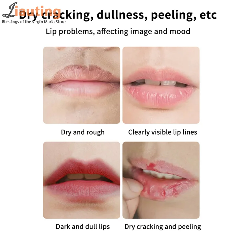 

Moisturizing Jelly Lip Mask Hydrating Exfoliating Lip Film To Remove Dead Skin Improve Dryness Nourishing Smooth Lip Care