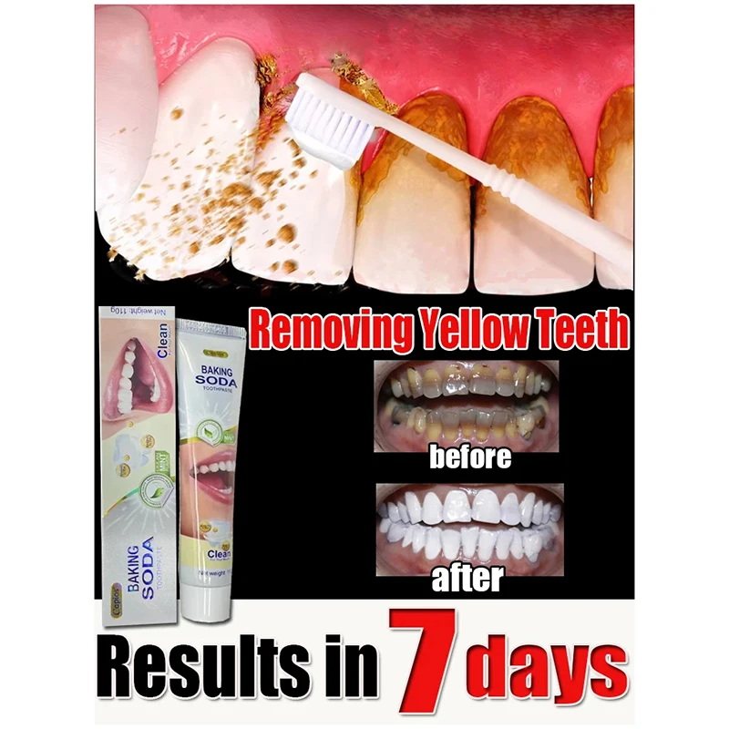 Toothpaste Remover Dental Calculus Whitening Teeth Mouth Odor Removal Bad Breath Preventing Periodontitis Dental Care Toothpaste