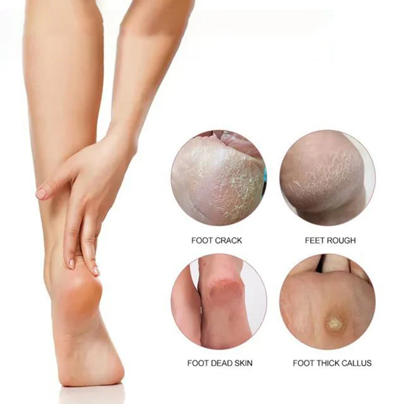 مبرد قدم من الفولاذ المقاوم للصدأ مسامير القدم على الوجهين وإزالة الجلد الميت، مطحنة القدم، فرك لوحة القدم