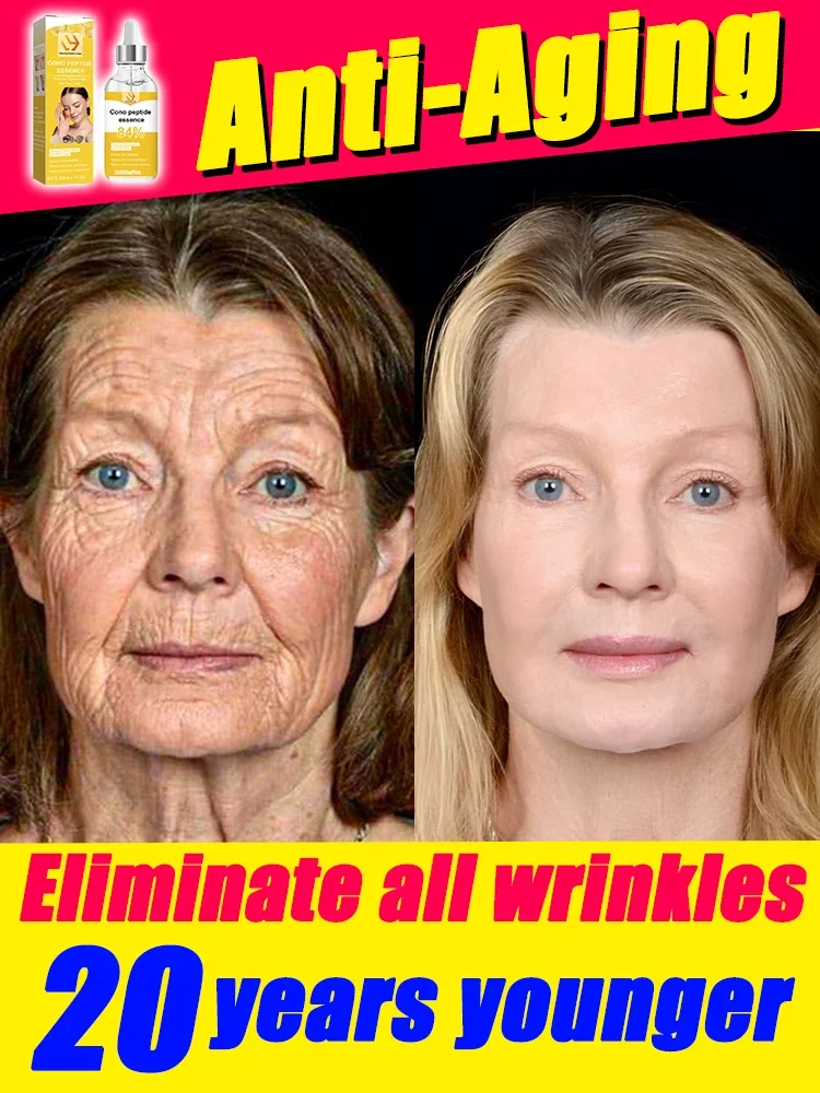 

Eliminate Neck Lines