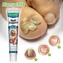 1pcs Nail Fungus Treatment Cream Toenail Onychomycosis Nail Repair Ointment Anti-fungal Infection Cream Psoriasis Ointment G048