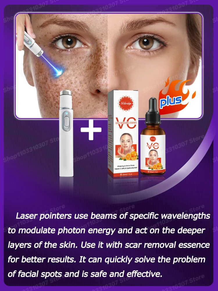 laser spots whitening