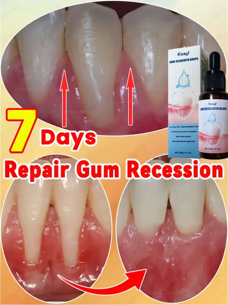 

Relieve Sore Gums Allergy