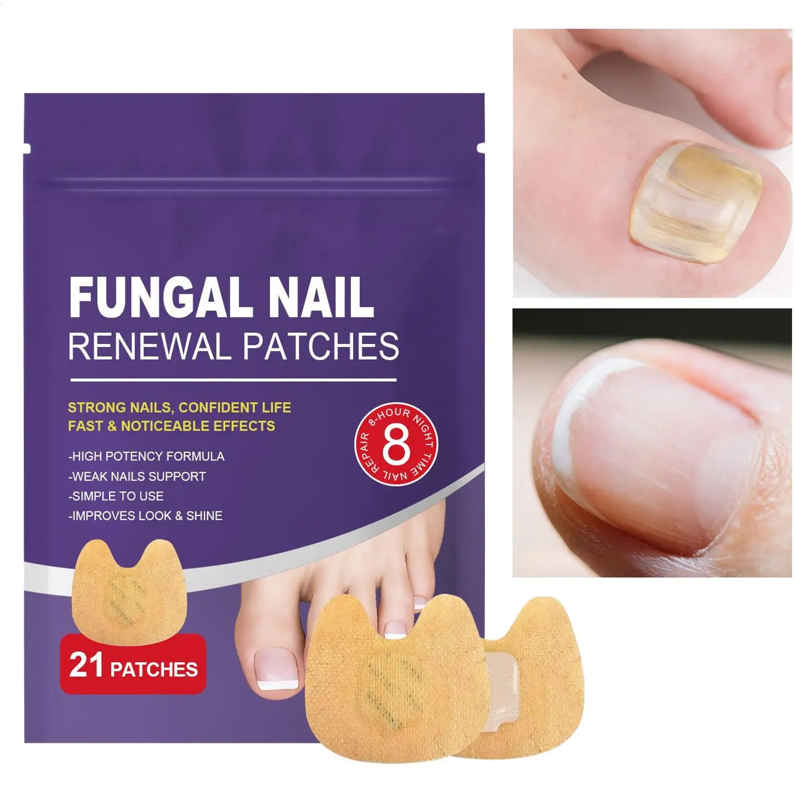 بقع الأظافر ملصقات مغذية لأظافر القدم رقع مغذية للعناية بالأظافر لإصلاح أظافر القدم التالفة والهشة للمنزل يوميًا