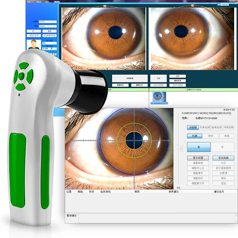 Suyzeko Portable Iridology Camera 12MP USB Iris Imaging Device with Auto Focus HD Software for Research & Training