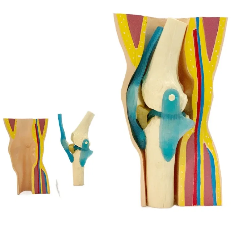 Removable Curved Simulation Skin Muscle Kneecap Meniscus Ligament Skeleton Model Human Knee Joint Anatomical  Anatomy Models