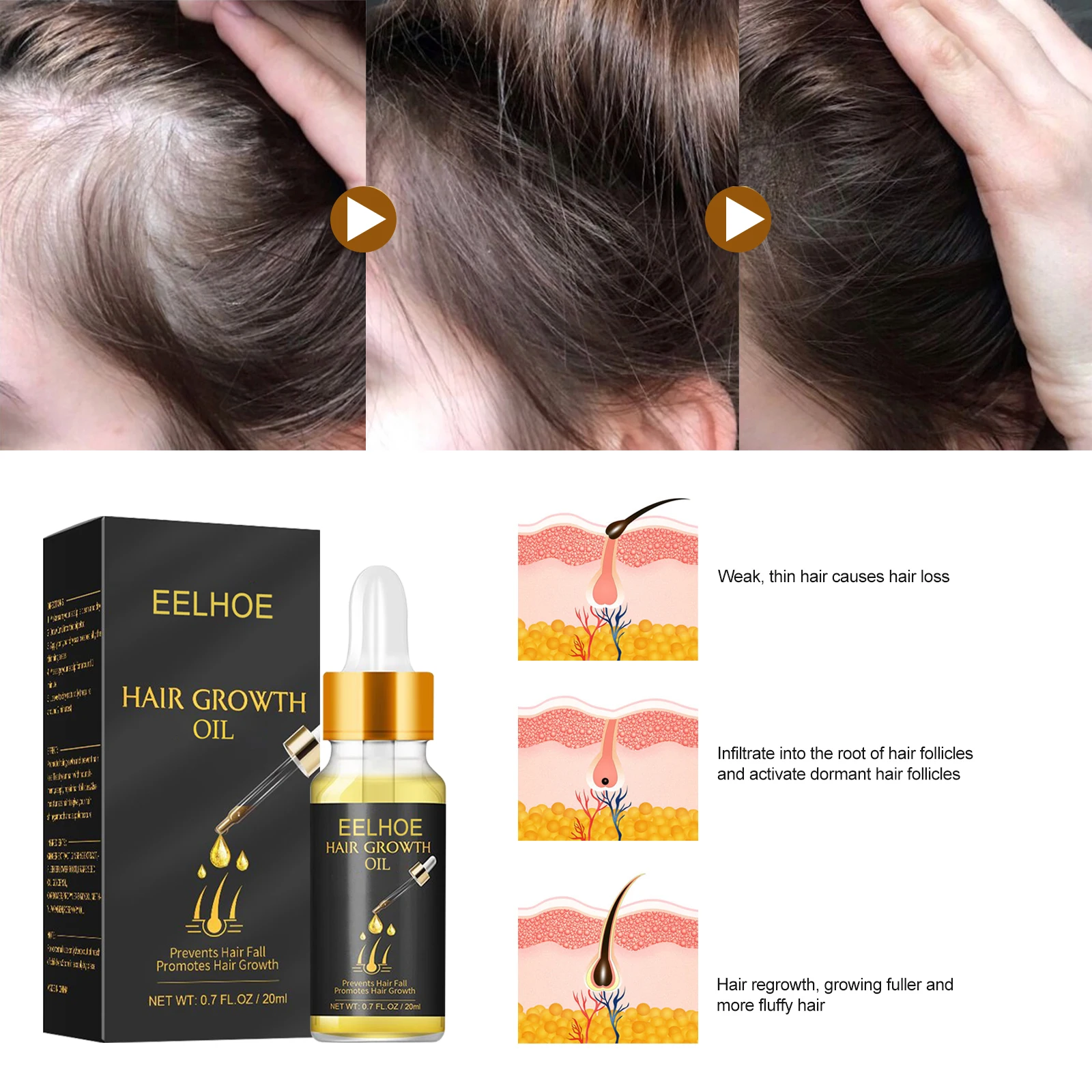 Dense Hair Essence Strong Firm Hair Care Soft & Nourishing Thick Hair Nutrition Liquid Strengthening Hair Anti Loss Hair Serum