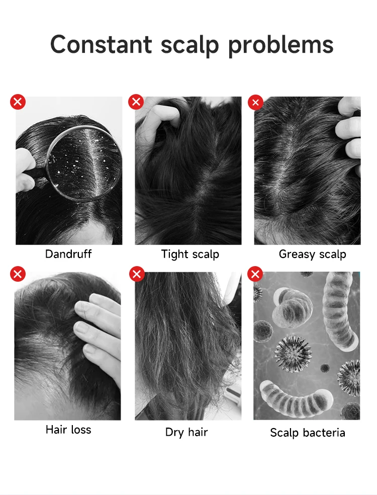 Analyseur de cheveux pour le traitement de la perte de cheveux, diagnostic de la peau, beauté et soins personnels