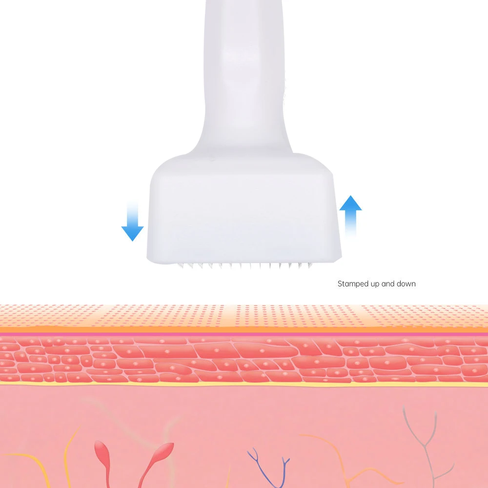 Beauty Derma Stamp Pen 140 Pins Titanium Microneedling Face Stamp Beard Roller For Hair Scalp Skin Care Tools