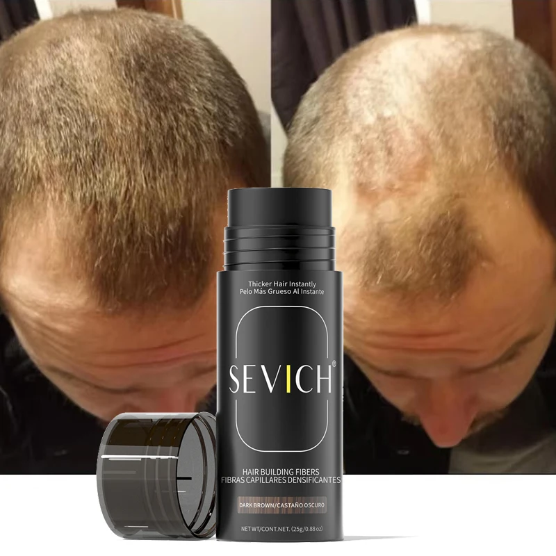 Hair Fiber Keratin Hair Loss Product 25g Natural Instant Hair Growth Fiber Thin Loss Treatment Powder Human Wig Extension