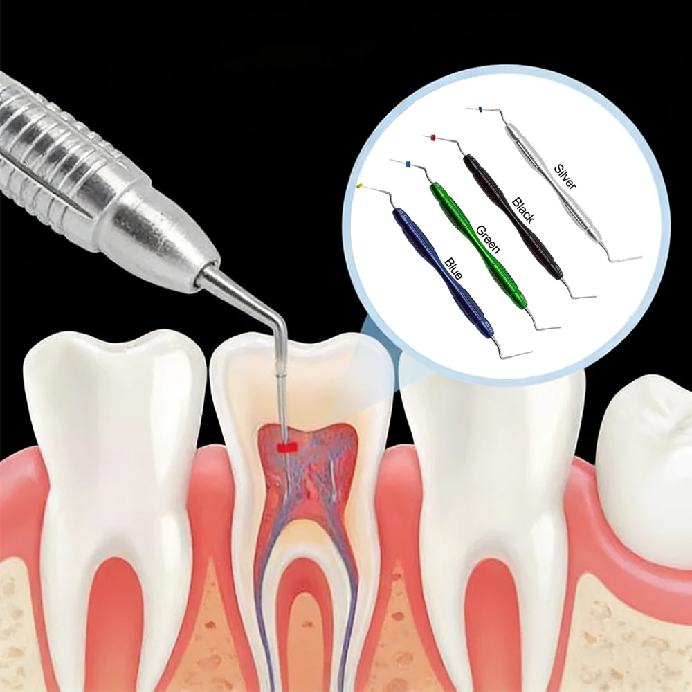 

Ручной инструмент для вертикальной компактации гуттаперчи при лечении корневых каналов – эндодонтический инструмент для заполнения каналов для стоматологов