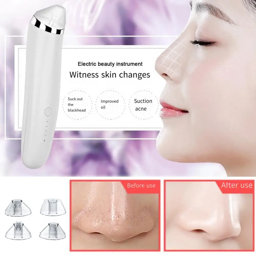 Pore Vacuum Cleaner Electric Blackhead Remover Vacuum with Usb Charging for Men Women Pore Cleaner for Keratin for Skin