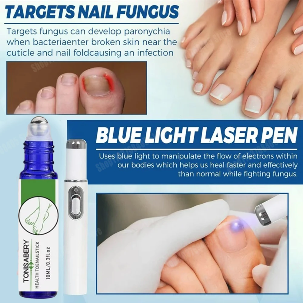 爪真菌レーザーペン 爪真菌クリーニングレーザー装置 爪真菌レーザー治療 損傷した変色した厚い足の爪