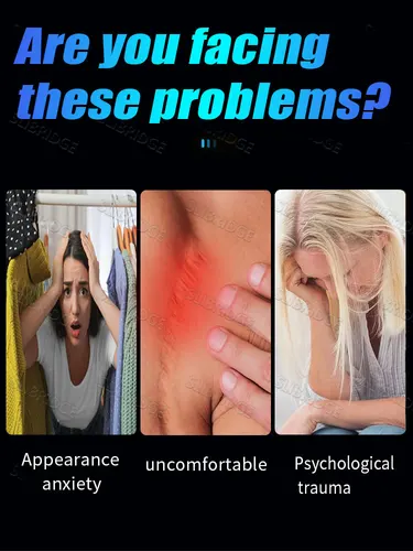 Imagen 2 del producto 2025Generation-2, bolígrafo de luz azul para resolver cicatrices