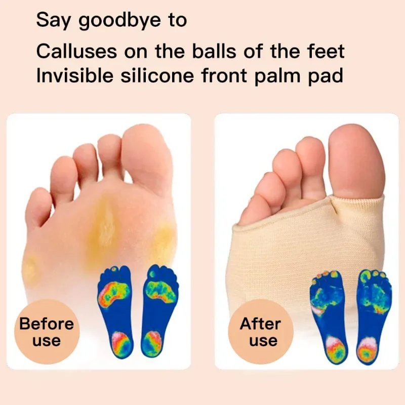 Silicone Gel Half Insoles for Metatarsal Forefoot Pain Relief Shoe Pads Ball of Foot Cushions for Hallux Valgus Corrector Socks