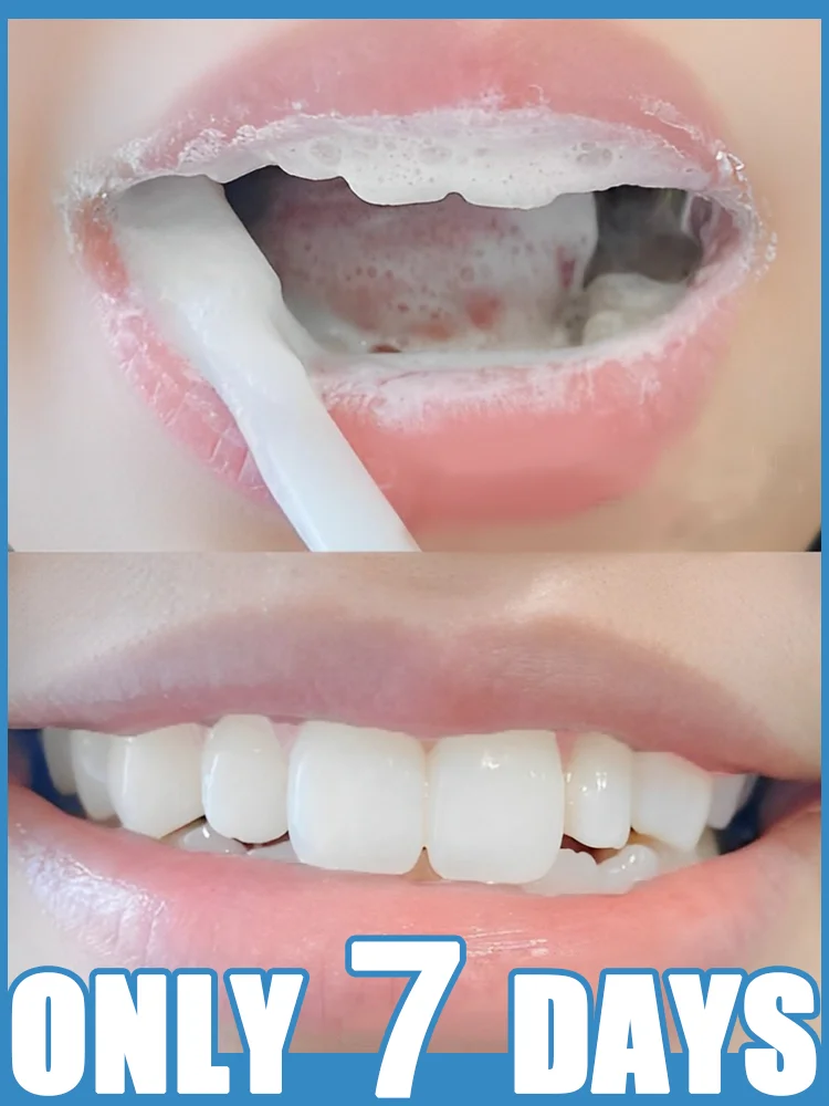 

Anti-Cavity Oral Serum: 99.9% Gum Repair & Bacteria Removal - Advanced Oral Care Formula