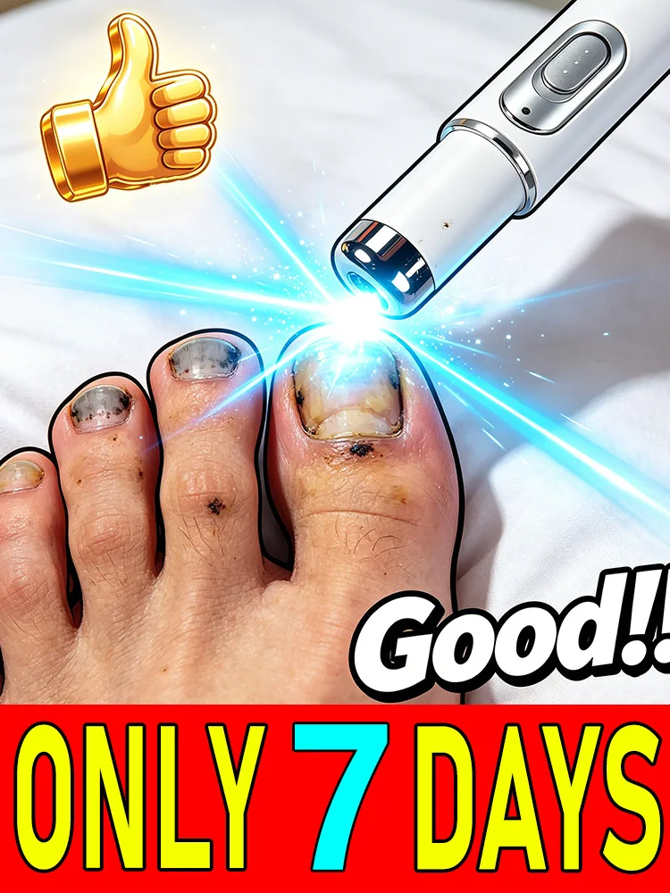 

Portable nail laser set releases nail discomfort and fits regular home daily maintenance for fungus infected thick nails