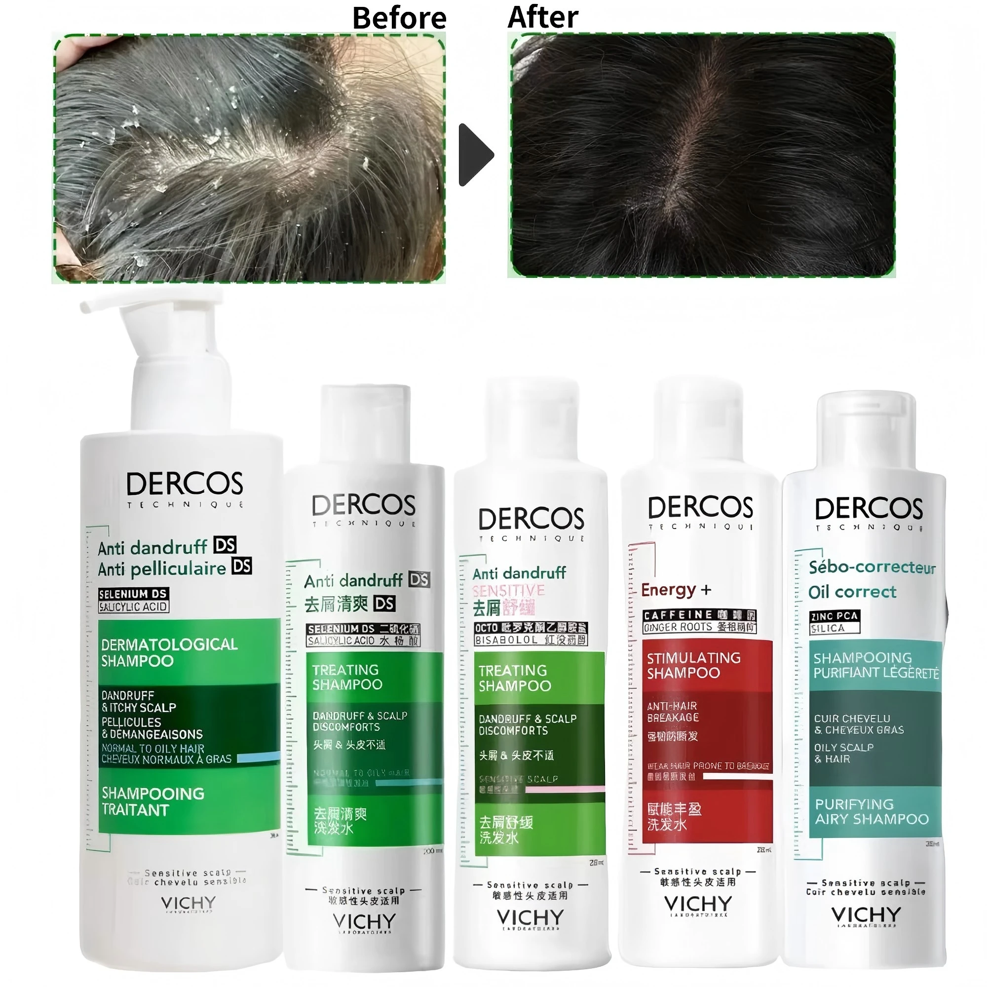 VICHY Shampoo -- 200/390ML Anti-Dandruff Purifying Shampoo, Oil Control Shampoo, Fluffy Shampoo, Smoothing Cleansing, Scalp Care