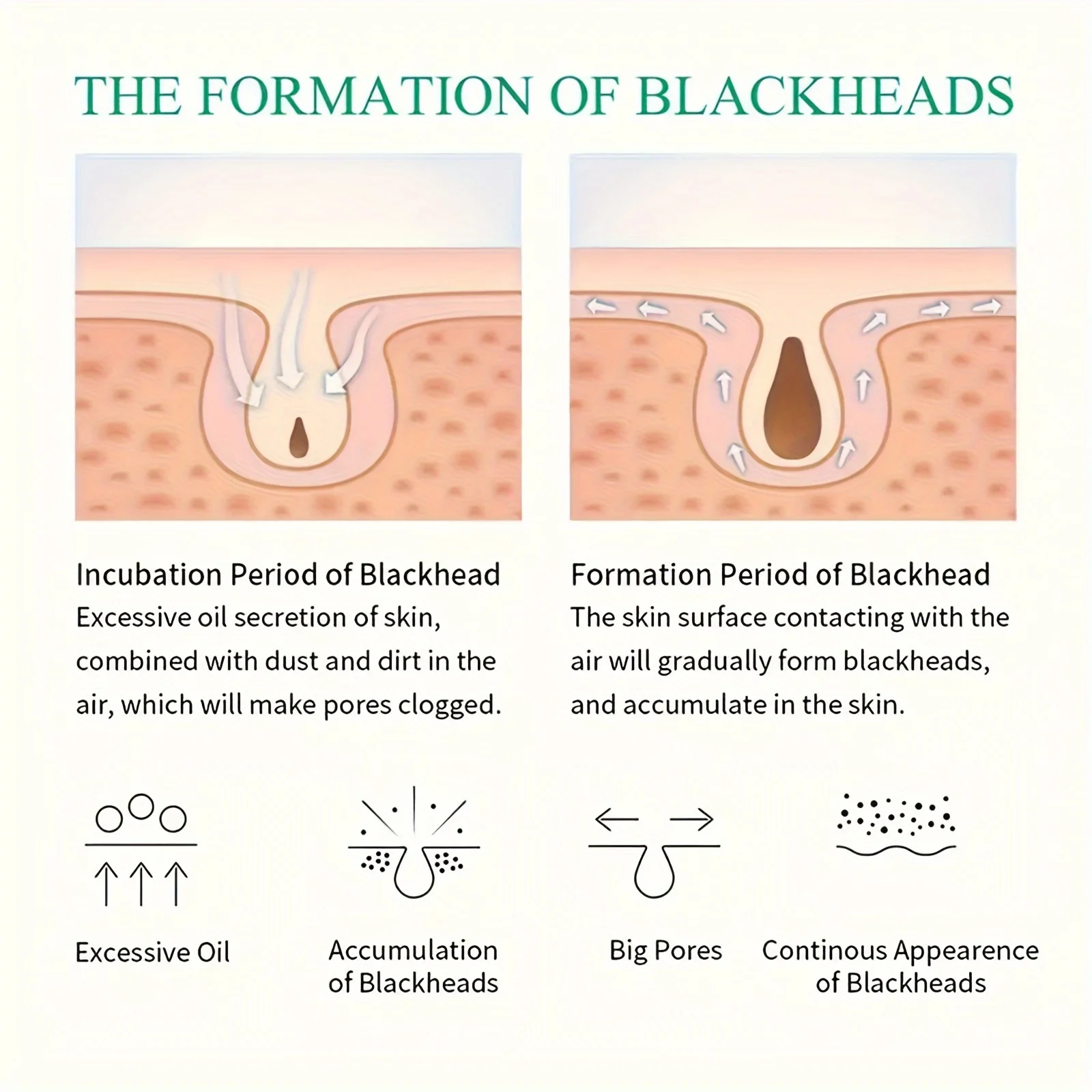 1 قطعة ملصق أنف، ملصق حب الشباب خفيف وغير مزعج، يغطي عيوب حب الشباب، مقاوم للماء وجيد التهوية.