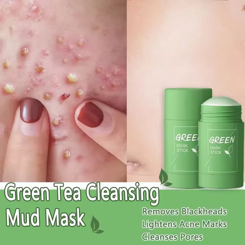 Original Facial Remove Blackhead Green Tea Solid Mask Treat Blemish Black Dots Acne Clean Stick Cream Shrink Pores Skin Care