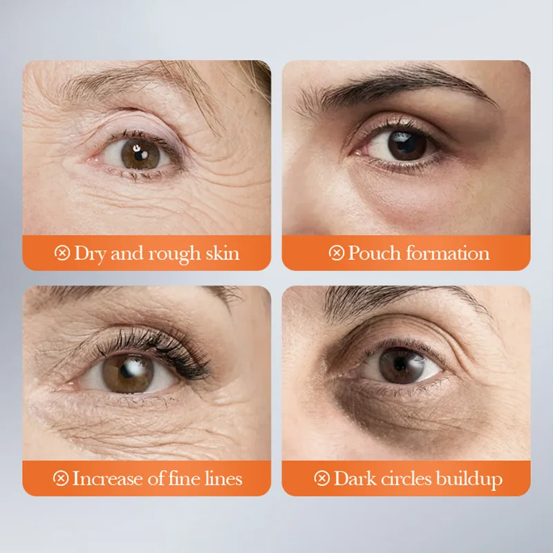 5 أزواج SADOER الأسود كريستال الكولاجين قناع عين المضادة للتجاعيد مكافحة الشيخوخة ترطيب مكافحة الهالات السوداء بقع عين أقنعة هلامية #3