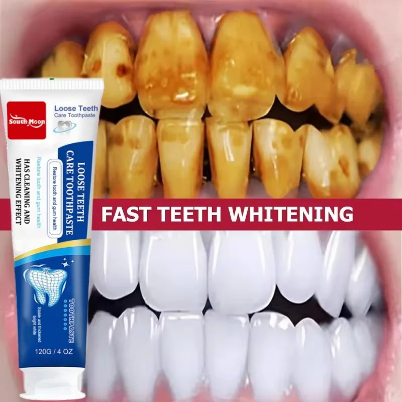 

120g Probiotic Toothpaste SP-4 Whitening Tooth Remove Plaque Stains Teeth Whitener Oral Hygiene Clean Fresh Breath Dental New